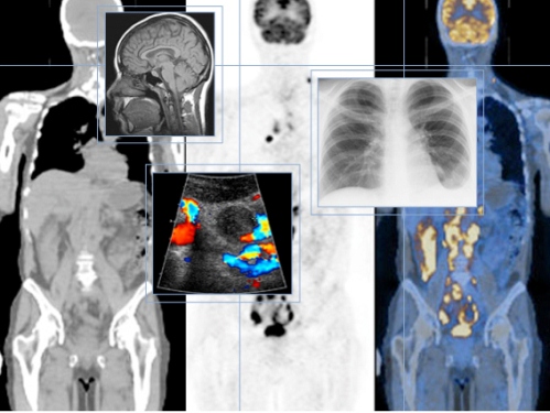 Ứng dụng công nghệ hạt nhân trong y học